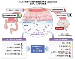 MCIに関連する腸内細菌叢の異常を解明